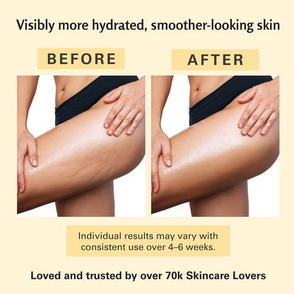 Anti-Cellulite Massage Oil